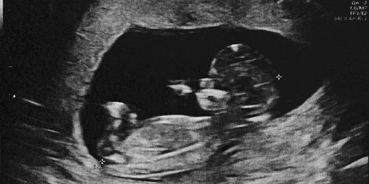 A Hong Kong, un crématorium pour dire adieu aux foetus