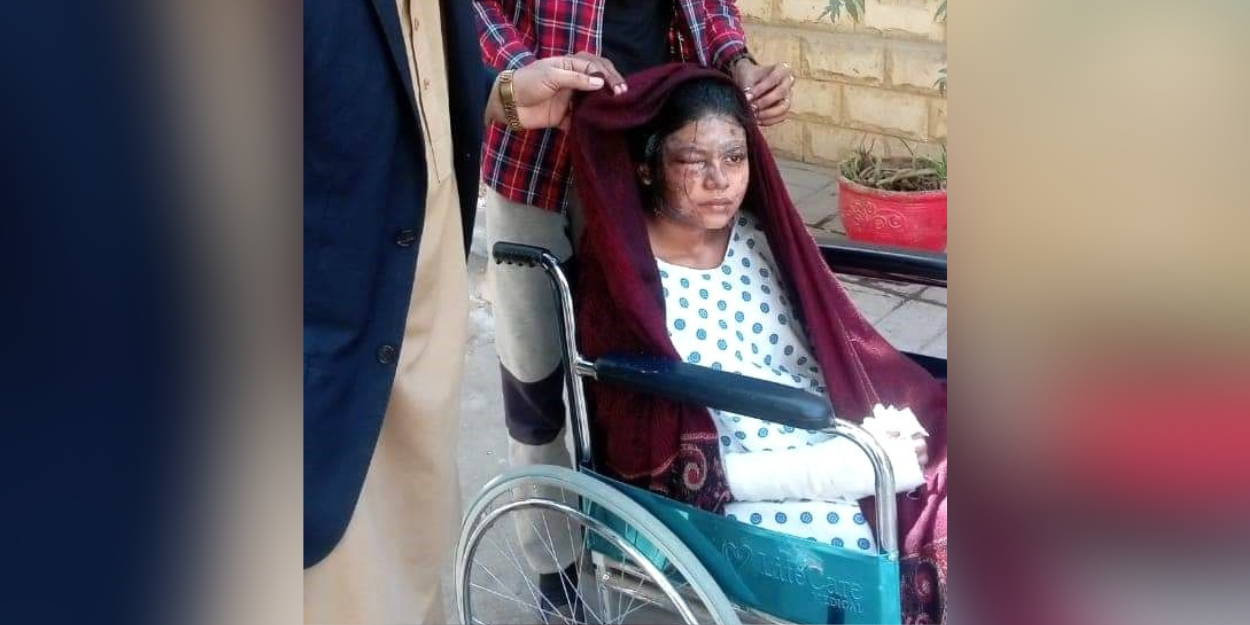 In Pakistan, a man attacks with acid a Christian who refused his marriage proposal (2)