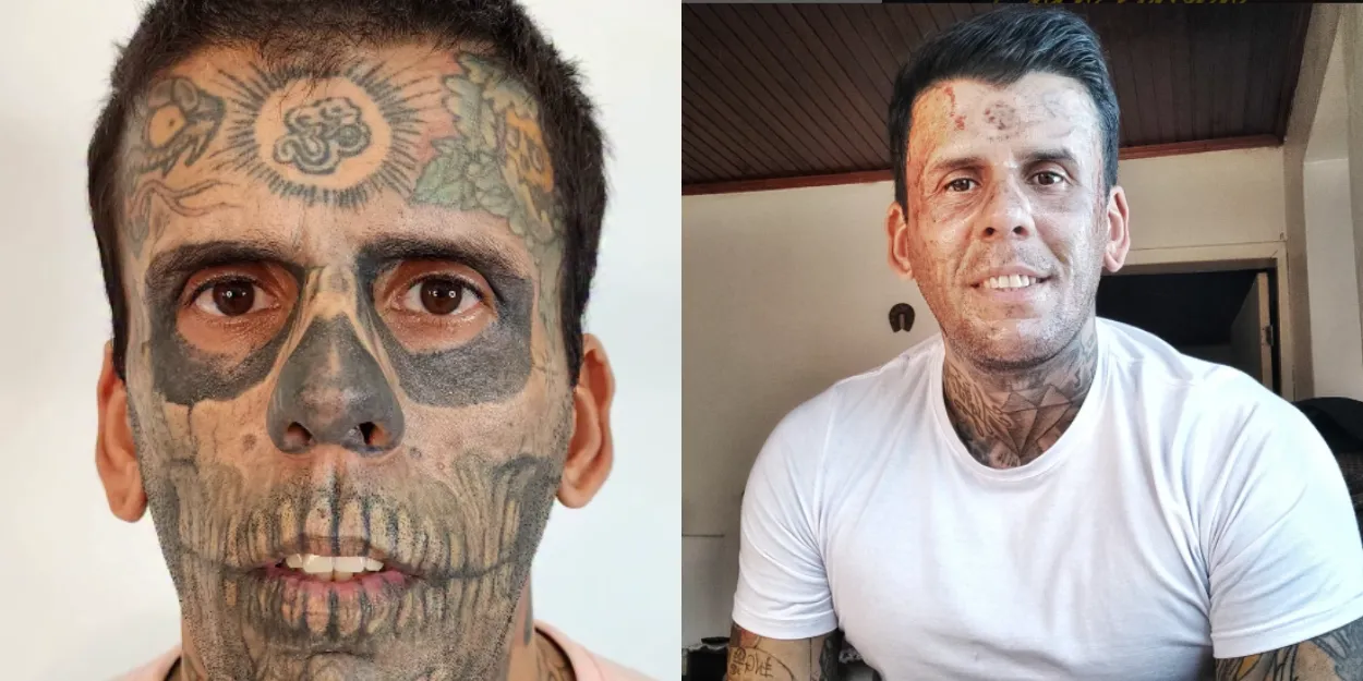 bresilien_plus_tatoue_rencontre_jesus_enleve_tatouages