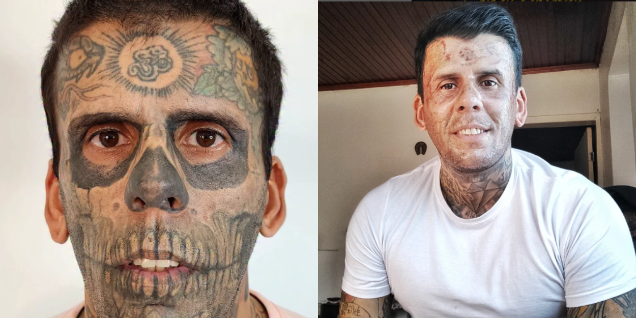 bresilien_plus_tatoue_rencontre_jesus_enleve_tatouages